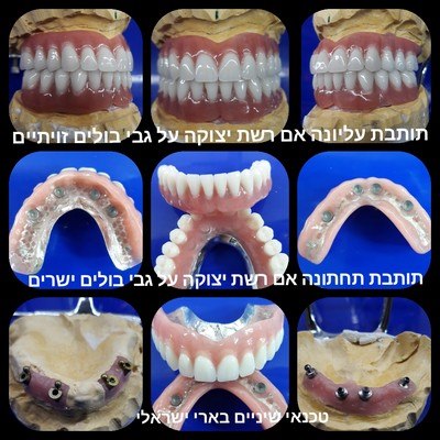 תמונה שצולמה להמחשת העבודות של בארי ישראלי תמונה של בארי ישראלי