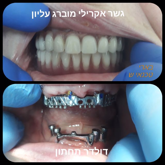 תמונה שצולמה להמחשת העבודות של בארי ישראלי תמונה של בארי ישראלי