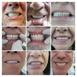 תמונה שצולמה להמחשת העבודות של בארי ישראלי תמונה של בארי ישראלי