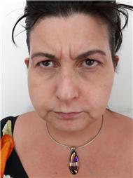 תמונה שצולמה להמחשת העבודות של ד"ר ולדימיר קרבצ'וב רפואה אסתטית תמונה של ד"ר ולדימיר קרבצ'וב רפואה אסתטית