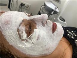 תמונה של אידית אלגרבלי המרכז לטיפולי פנים