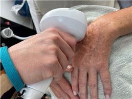 תמונה של אידית אלגרבלי המרכז לטיפולי פנים