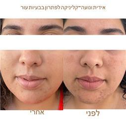 תמונה של אידית אלגרבלי המרכז לטיפולי פנים