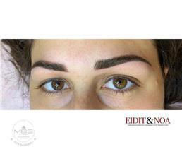 תמונה שצולמה להמחשת העבודות של אידית אלגרבלי המרכז לטיפולי פנים תמונה של אידית אלגרבלי המרכז לטיפולי פנים