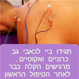 תמונה של סבטלנה- דיקור סיני בעכו