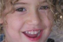 תמונה שצולמה להמחשת העבודות של ד"ר די קפואה פאולו - 3 טיפול שיניים לילדים